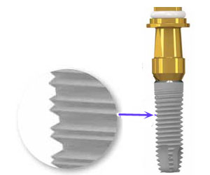 implante dental titanio